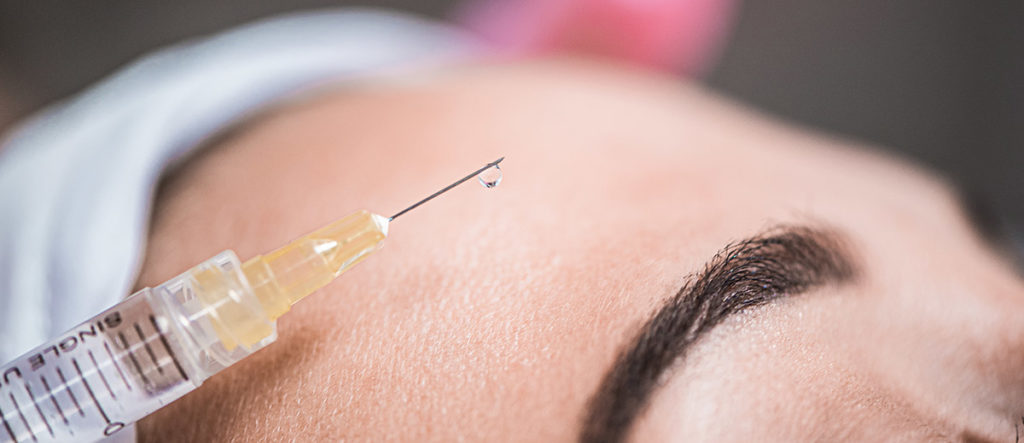 Muskelrelaxans wird vom Dermatologen mit sehr feinen Injektionsnadeln punktgenau unter der Haut platziert