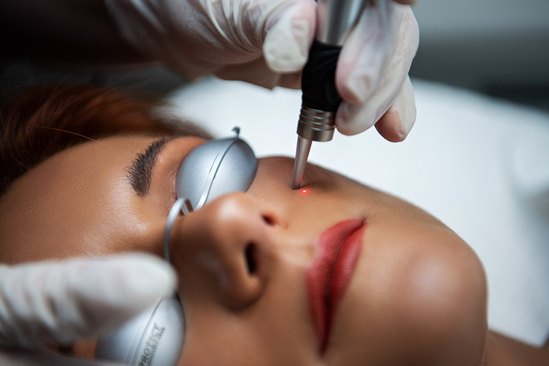 Nach der QuadroStar Behandlung sieht die Haut wieder jung und gesund aus - FineSkin - Ästhetische Chirurgie - Augenlidstraffung - Brustvergrösserung – Fettabsaugung - 3D Simulation (Beratung) - Ästhetische Dermatologie - Hyaluron - Muskelrelaxans - Fettwegspritze - Fadenlifting - PRP Vampire Lifting - TCA-Peeling - Medizinische Kosmetik (Gesicht) - Observer-Hautanalyse - HydraFacial - Mesotherapie - QuadroStar - Secret RF Microneedling - Diodenlaser MeDioStar - IS Clinical Fire & Ice - Chemische Peelings - Fruchtsäurepeeling -ICOONE Laser - Seyo TDA Beautysystem -Ultraschallbehandlung - BB Glow Microneedling - Klassiche Gesichtsbehandlung - Medizinische Kosmetik (Körper) - Kryolipolyse - ICOONE Laser Body - Secret RF Microneedling Body - Dauerhafte Haarentfernung - VIP Line Elektrotherapie Body - Methode Brigitte Kettner - iS Clinical - Aesthetico - IMAGE Skincare - Beauty Secrets