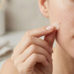 Nahaufnahme: Hand mit Pickel-Patch als sanfte Soforthilfe – Pickel entfernen ohne Drücken und ohne starke Reizung.